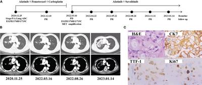 Case Report: The effective treatment of patients in advanced no-small cell lung cancer patients with EGFR G719X/S768I/L861Q and acquired MET amplification: A case series and literature review